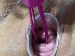 mature-wife-fucking-cervix-and-penetration-in-uterus